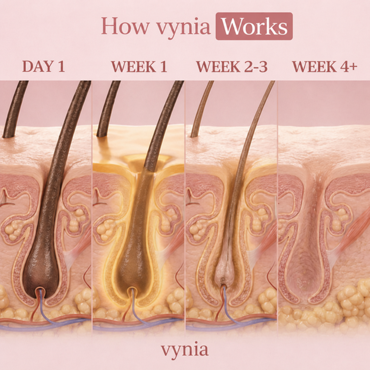 Hair Reduction Formula